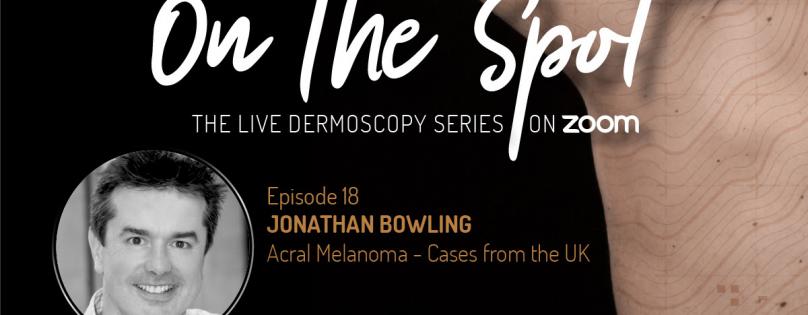 Dermlite Webinar: Episode E18