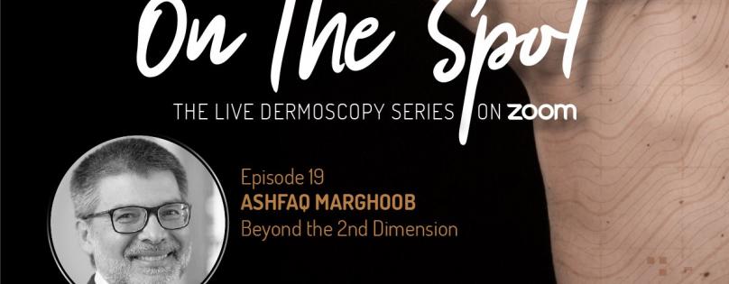 Dermlite Webinar: EP 19