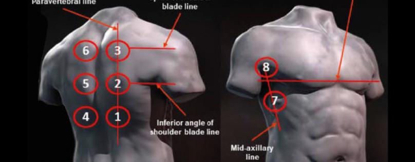 LUNG ULTRASOUND IN COVID PATIENTS